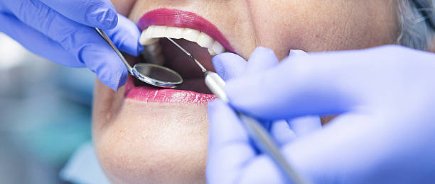 Best Emergency Tooth Extraction in Ridgeville, SC